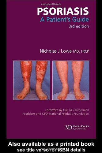 Psoriasis A Patients Guide 3rd Edition Nicholas J Lowe