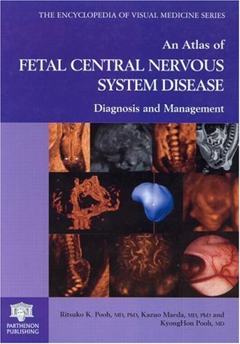 An Atlas Of Fetal Central Nervous System Disease Diagnosis And Management 1st Edition Ritsuko K Pooh