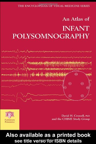 An Atlas Of Infant Polysomnography 1st Edition David H Crowell