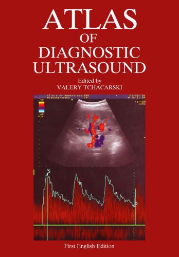 Waldmans Atlas Of Diagnostic Ultrasound Of Painful Foot And Ankle Conditions Tchacarski