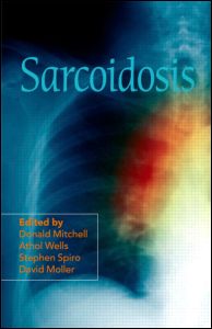 Sarcoidosis 1st Edition Donald Mitchell Editor Athol Wells Editor Stephen Spiro Editor David Moller Editor