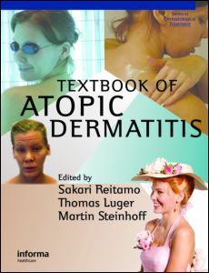 Textbook Of Atopic Dermatitis 1st Edition Sakari Reitamo Author Thomas A Luger Author Martin Steinhoff Author