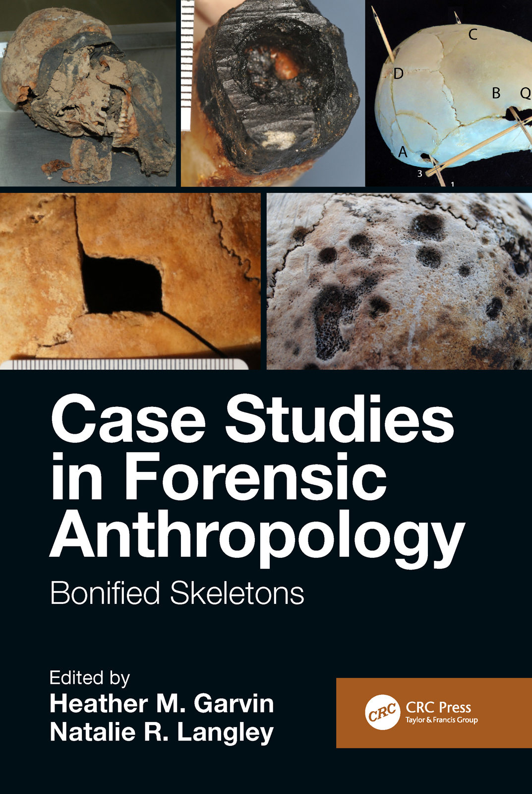 Case Studies In Forensic Anthropology Bonified Skeletons 1st Edition Heather M Garvin Editor Natalie R Langley Editor