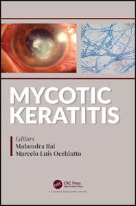 Mycotic Keratitis 1st Edition Mahendra Rai Editor Marcelo Luis Occhiutto Editor