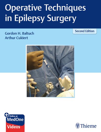 Operative Techniques In Epilepsy Surgery 2nd Edition Jeanguy Villemure
