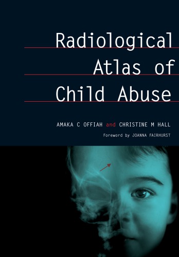 Radiological Atlas Of Child Abuse A Complete Resource For Mcqs V 1 1st Edition Amaka Offiah Author Christine Hall Author