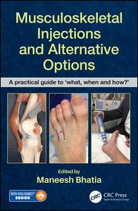 Musculoskeletal Injections And Alternative Options A Practical Guide To What When And How 1st Edition Maneesh Bhatia Editor