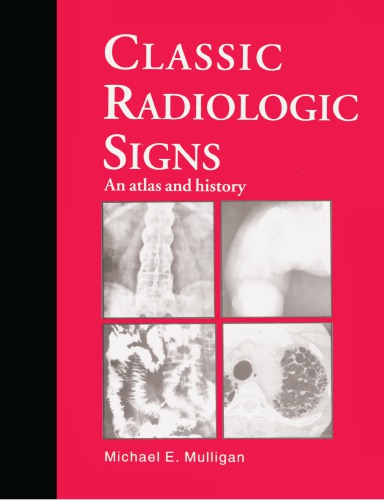 Classic Radiologic Signs An Atlas And History Mulligan Michael E
