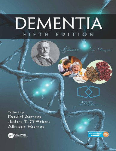 Dementia Fifth Edition Fifth Edition David Ames Alistair Burns