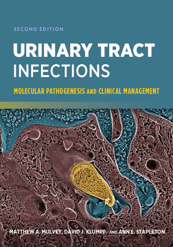 Urinary Tract Infections Molecular Pathogenesis And Clinical Management Matthew A Mulvey