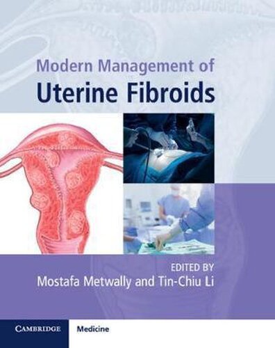 Modern Management Of Uterine Fibroids Mostafa Metwally Tinchiu Li