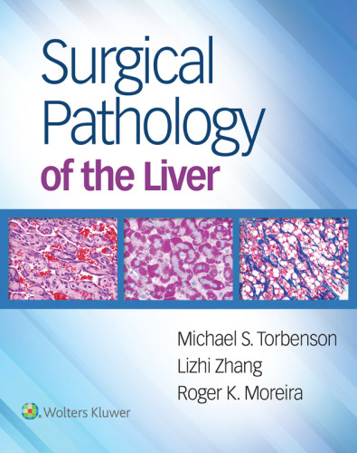 Surgical Pathology Of The Liver Michael S Torbenson Md Lizhi Zhang