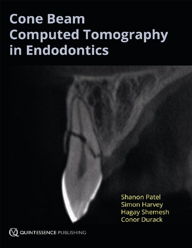 Cone Beam Computed Tomography In Endodontics 1 Edicin Shanon Patel Simon Harvey Hagay Shemesh Conor Durack