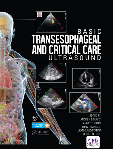 Basic Transesophageal And Critical Care Ultrasound Andr Y Denault