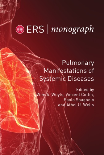 Pulmonary Manifestations Of Systemic Diseases 1st Wim A Wuyts