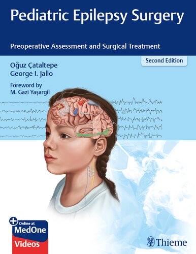 Pediatric Epilepsy Surgery Preoperative Assessment And Surgical Treatment 2nd Edition Oguz Cataltepe