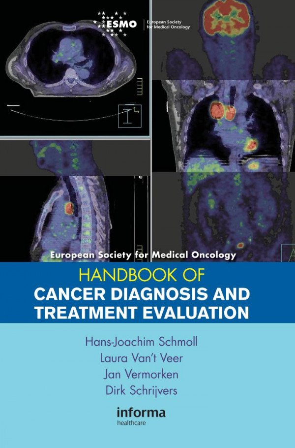Esmo Handbook Of Cancer Diagnosis And Treatment Evaluation 1st Edition Hansjoachim Schmoll Editor Laura Vant Meer Editor Jan Vermorken Editor Dirk Schrijvers Editor