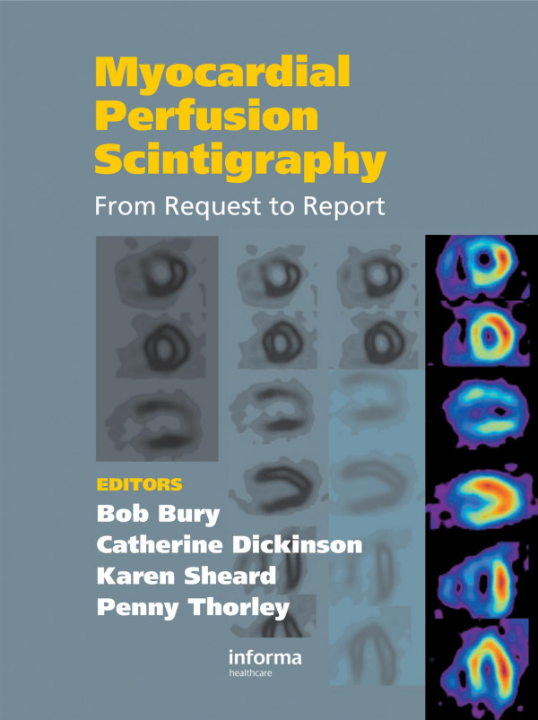 Myocardial Perfusion Scintigraphy From Request To Report 1st Edition Bob Bury Author Catherine Dickinson Author Karen Sheard Author Penny Thorley Author