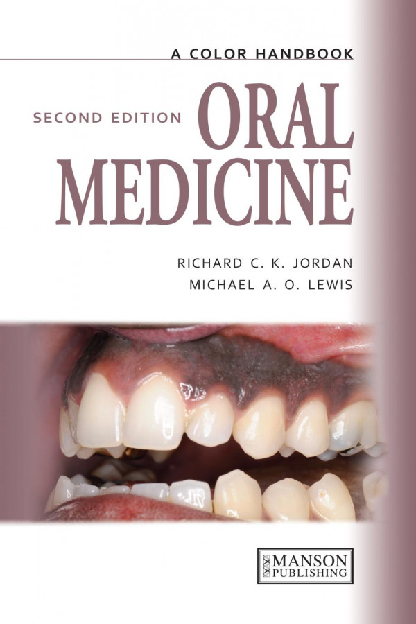 Oral Medicine 2nd Edition Michael Lewis Author Richard Jordan Author