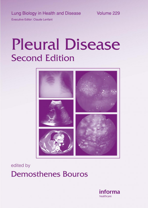 Pleural Disease 2nd Edition Demosthenes Bouros Editor