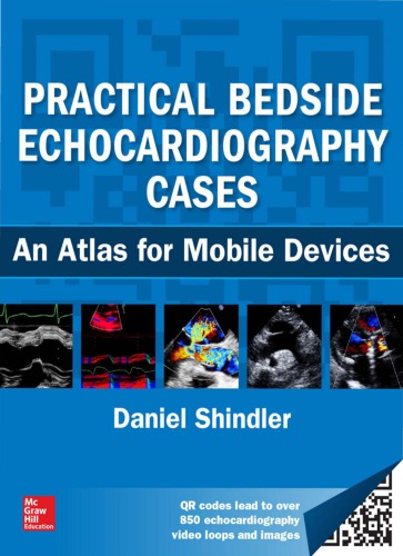 Practical Bedside Echocardiography Cases An Atlas For Mobile Devices 1st Daniel M Shindler