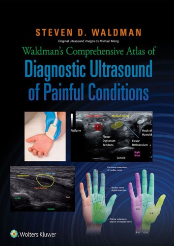 Waldmans Comprehensive Atlas Of Diagnostic Ultrasound Of Painful Conditions 1st Steven D Waldman