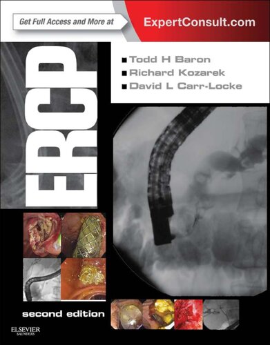 Ercp 2nd Edition Todd H Baron Richard A Kozarek David Leslie Carrlocke