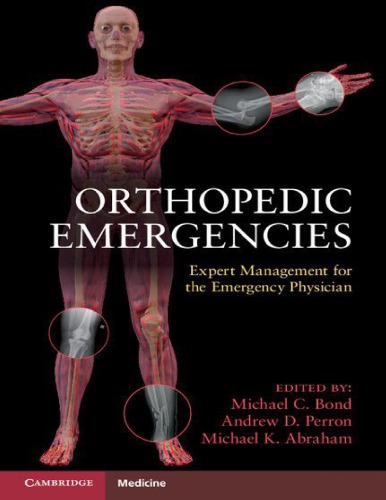 Orthopedic Emergencies Expert Management For The Emergency Physician 1st Michael C Bond