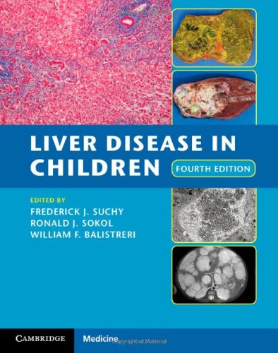 Liver Disease In Children 4th Edition Frederick J Suchy Ronald J Sokol