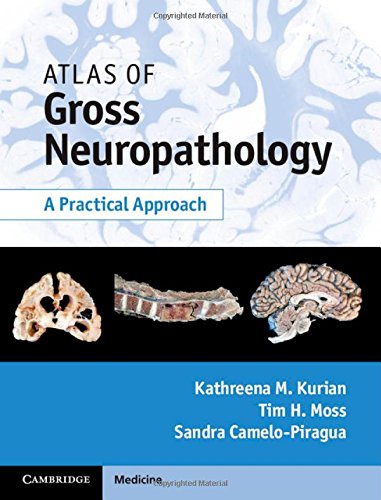 Atlas Of Gross Neuropathology A Practical Approach Harpsc Kathreena M Kurian