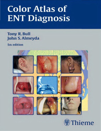 Color Atlas Of Ent Diagnosis 5th Edition Tony R Bull John S Almeyda