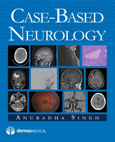 Casebased Neurology 1st Anuradha Singh