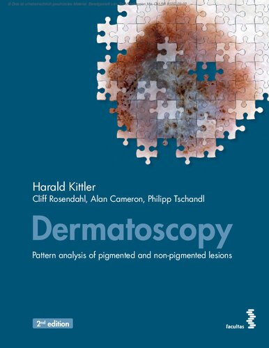 Dermatoscopy Pattern Analysis Of Pigmented And Nonpigmented Lesions 2nd Edition Harald Kittler