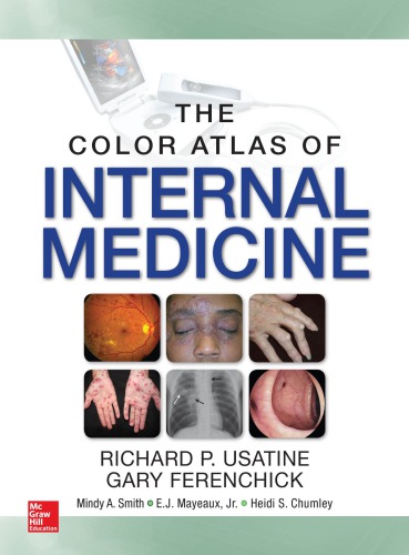 The Color Atlas Of Internal Medicine 1st Richard Usatine Gary Ferenchick