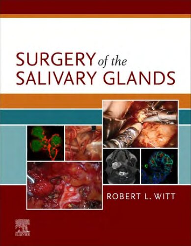 Surgery Of The Salivary Glands 1st Edition Robert L Witt Md
