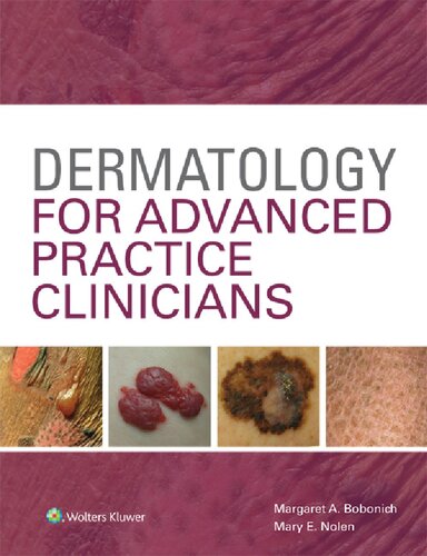 Dermatology For Advanced Practice Clinicians 1st Edition Margaret Bobonich