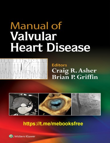Manual Of Valvular Heart Disease 1st Craig R Asher Brian P Griffin
