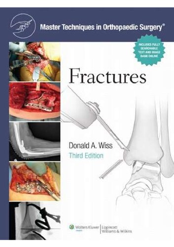 Master Techniques In Orthopaedic Surgery Fractures Third Edition 3rd Edition Donald A Wiss