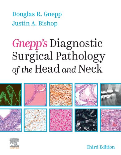 Gnepps Diagnostic Surgical Pathology Of The Head And Neck Third Douglas Gnepp