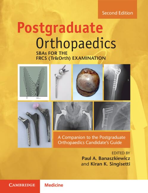 Sbas For The Frcs Trorth Examination A Companion To The Postgraduate Orthopaedics Candidates Guide 2e Jan 31 20251009287923cambridge University Presspdf 2nd Edition Paul A Banaszkiewicz
