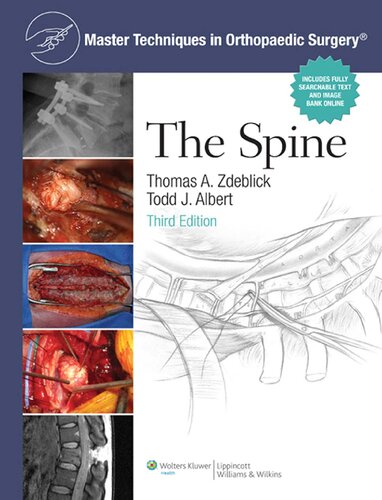 Master Techniques In Orthopaedic Surgery The Spine 3rd Edition 3rd Edition Thomas A Zdeblick