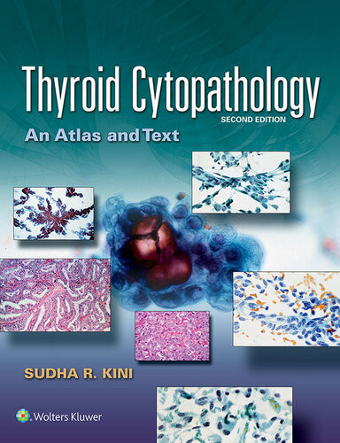 Thyroid Cytopathology Sudha R Kini