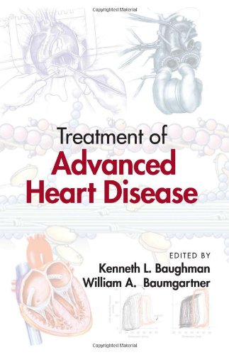 Treatment Of Advanced Heart Disease 1st Edition Kenneth L Baughman