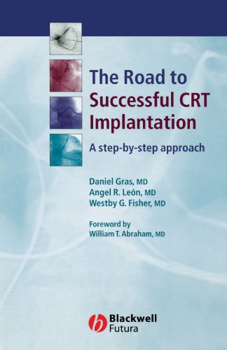 The Road To Successful Crt System Implantation A Stepbystep Approach 1st Edition Daniel Gras