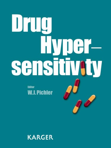 Drug Hypersensitivity 1st Edition W J Pichler