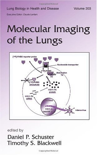 Molecular Imaging Of The Lungs 1st Edition Daniel Schuster Timothy Blackwell