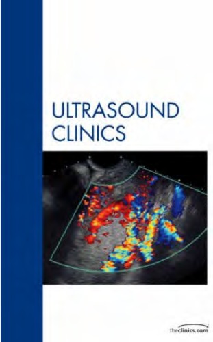 Advanced Obstetrical Ultrasound Fetal Brain Spine And Limb Abnormalities An Issue Of Ultrasound Clinics 1st Edition Noam Lazebnik