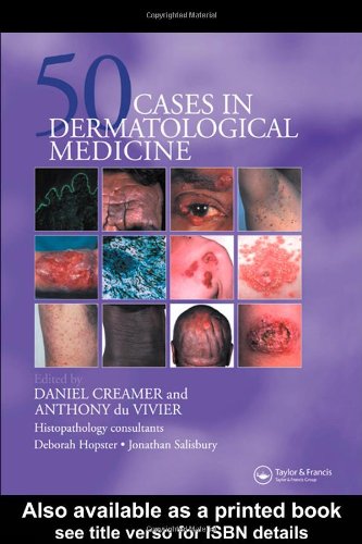 Fifty Cases In Dermatological Medicine 1st Edition Daniel Creamer Ed