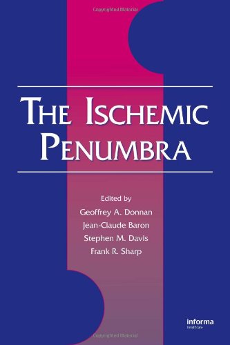 The Ischemic Penumbra Neurological Disease And Therapy 1st Edition Geoffrey A Donnan