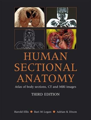 Human Sectional Anatomy Atlas Of Body Sections Ct And Mri Images 3rd Edition Harold Ellis